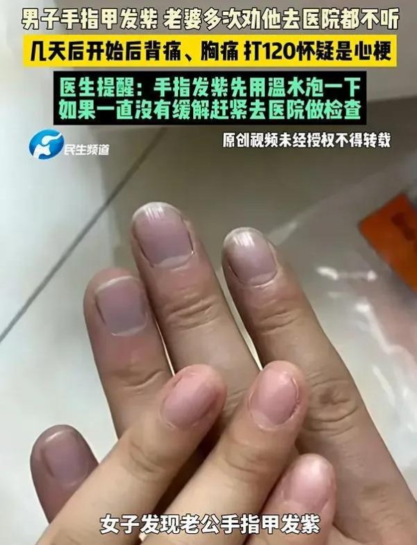 手指出现这5种征兆，最好去检查一下，心脏可能“病”得不轻了